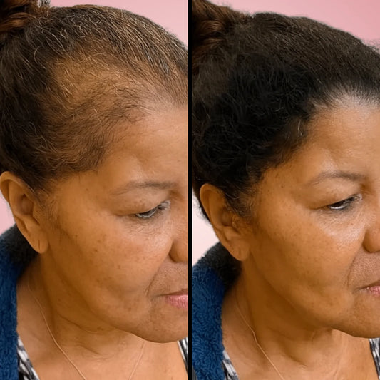 Luminé® Scalp Revive Serum | Boost Hair Growth Naturally