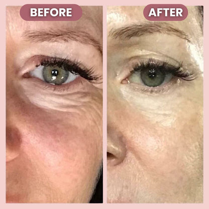 Luminé® Silver Lift Eye Cream | Illuminate your eyes with timeless lift