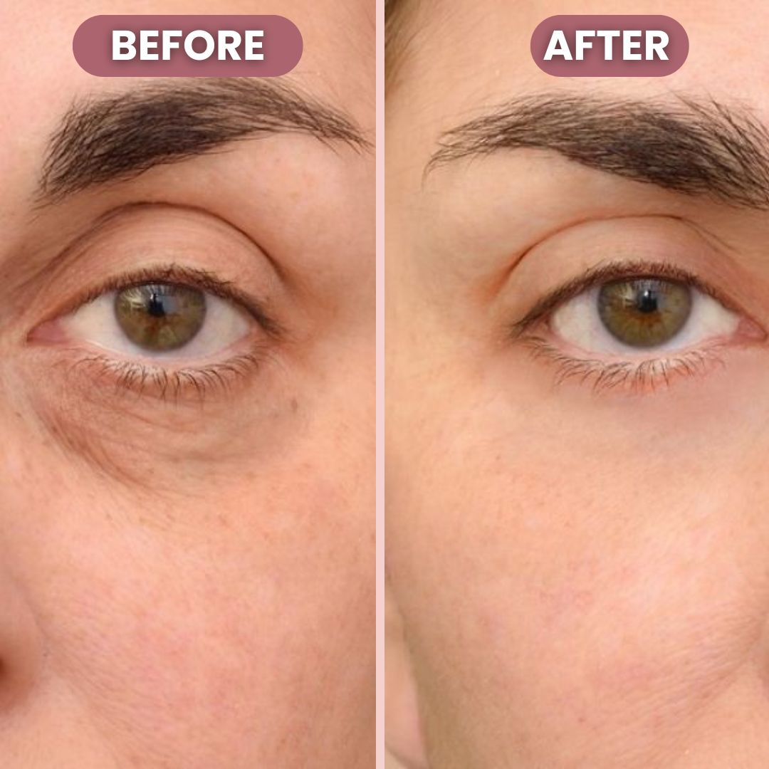 Luminé® Silver Lift Eye Cream | Illuminate your eyes with timeless lift