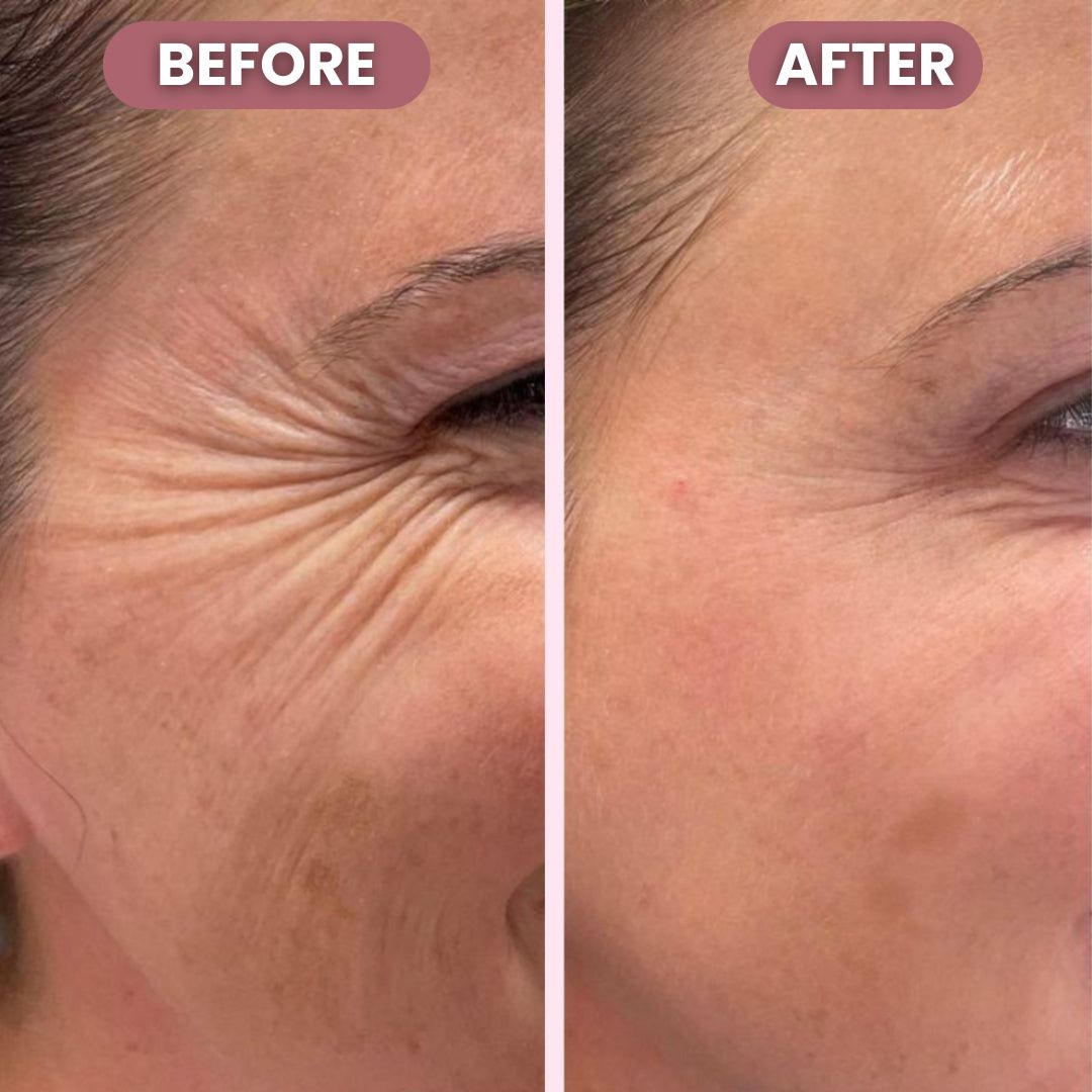 Luminé® Silver Lift Eye Cream | Illuminate your eyes with timeless lift