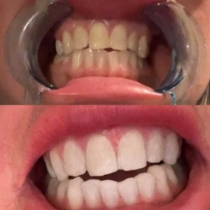 Before