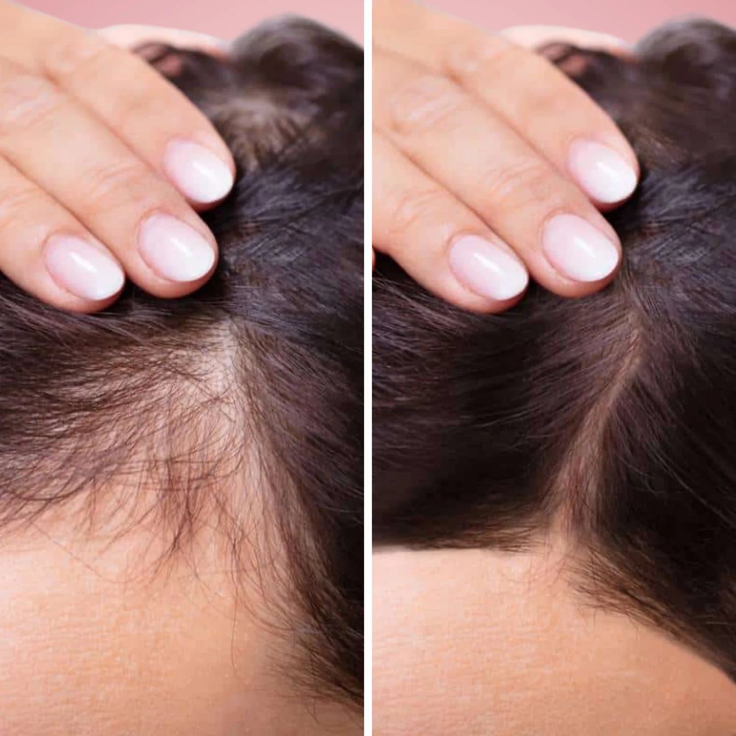 Luminé® Scalp Revive Serum | Boost Hair Growth Naturally